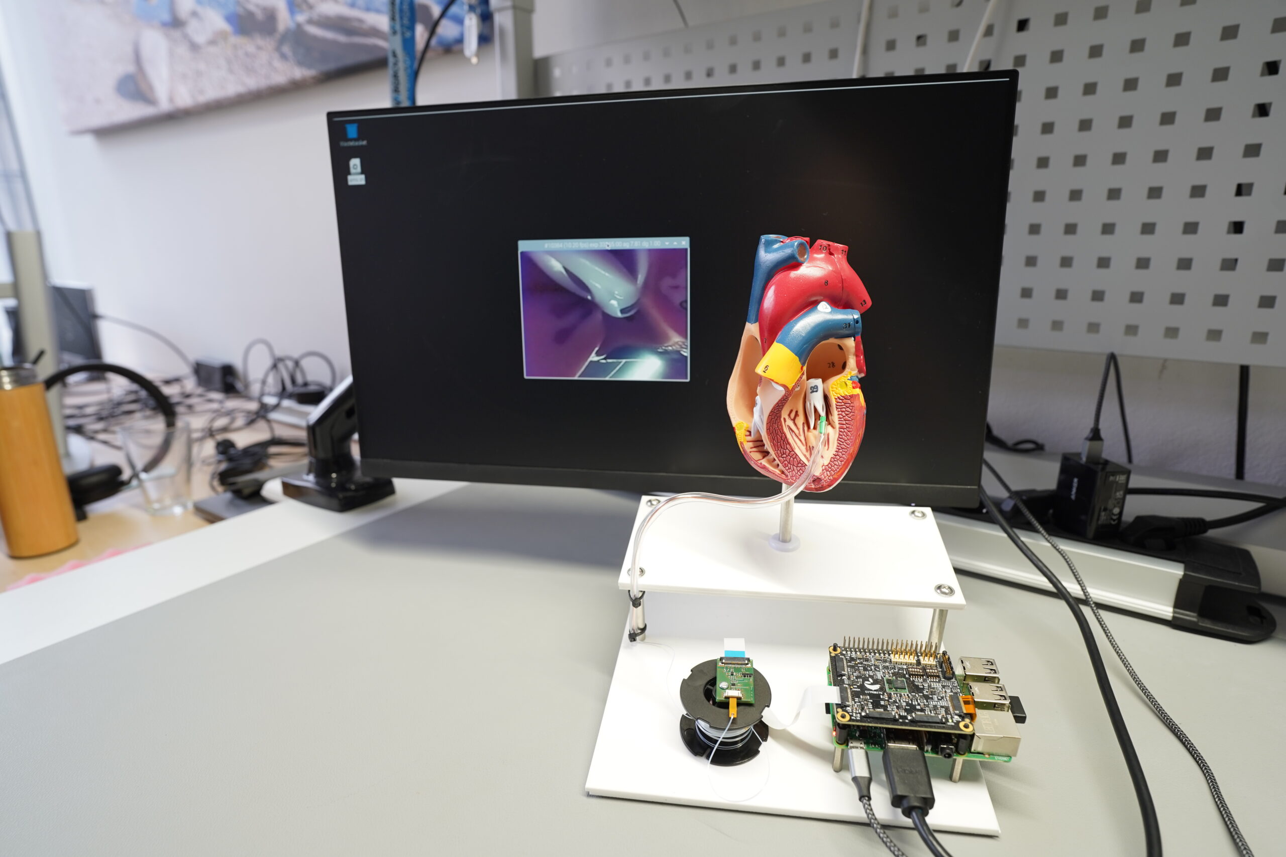 Endoscopic sensor bridge Endoscopic sensor bridge